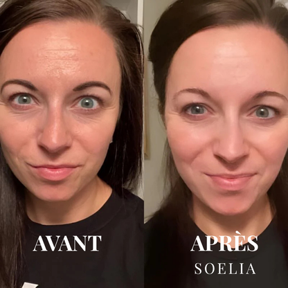 Soeliabeauty™ - Éclat Flash | Le Sérum Coréen Exfoliant au Riz