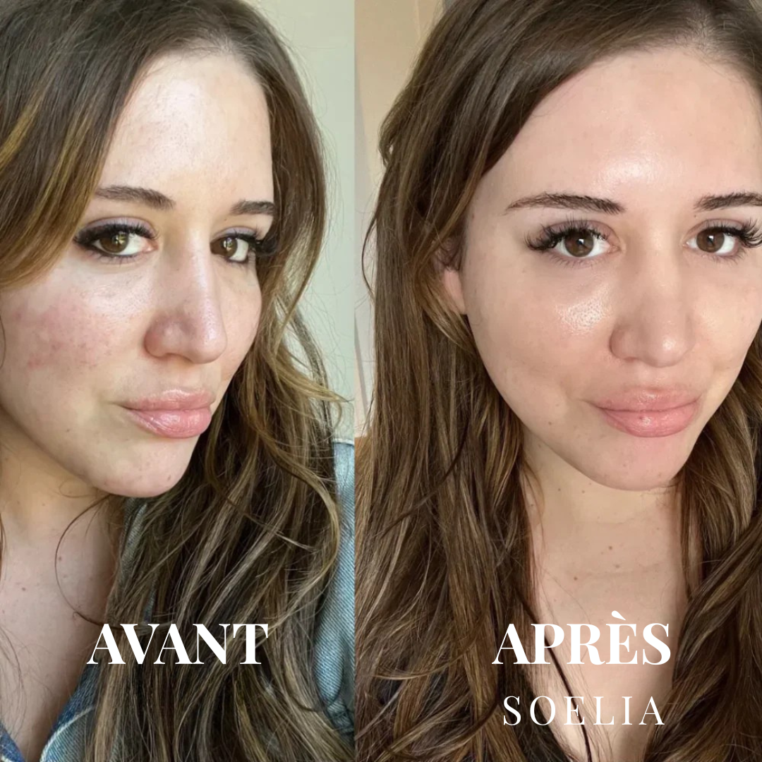 Soeliabeauty™ - Éclat Flash | Le Sérum Coréen Exfoliant au Riz
