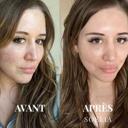Soeliabeauty™ - Éclat Flash | Le Sérum Coréen Exfoliant au Riz